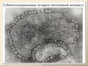 BE2011L10F019.jpg